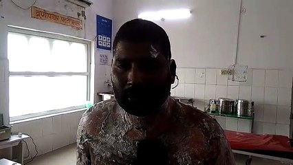 पुलिस ने जलने के बाद युवक को जिला अस्पताल में कराया भर्ती