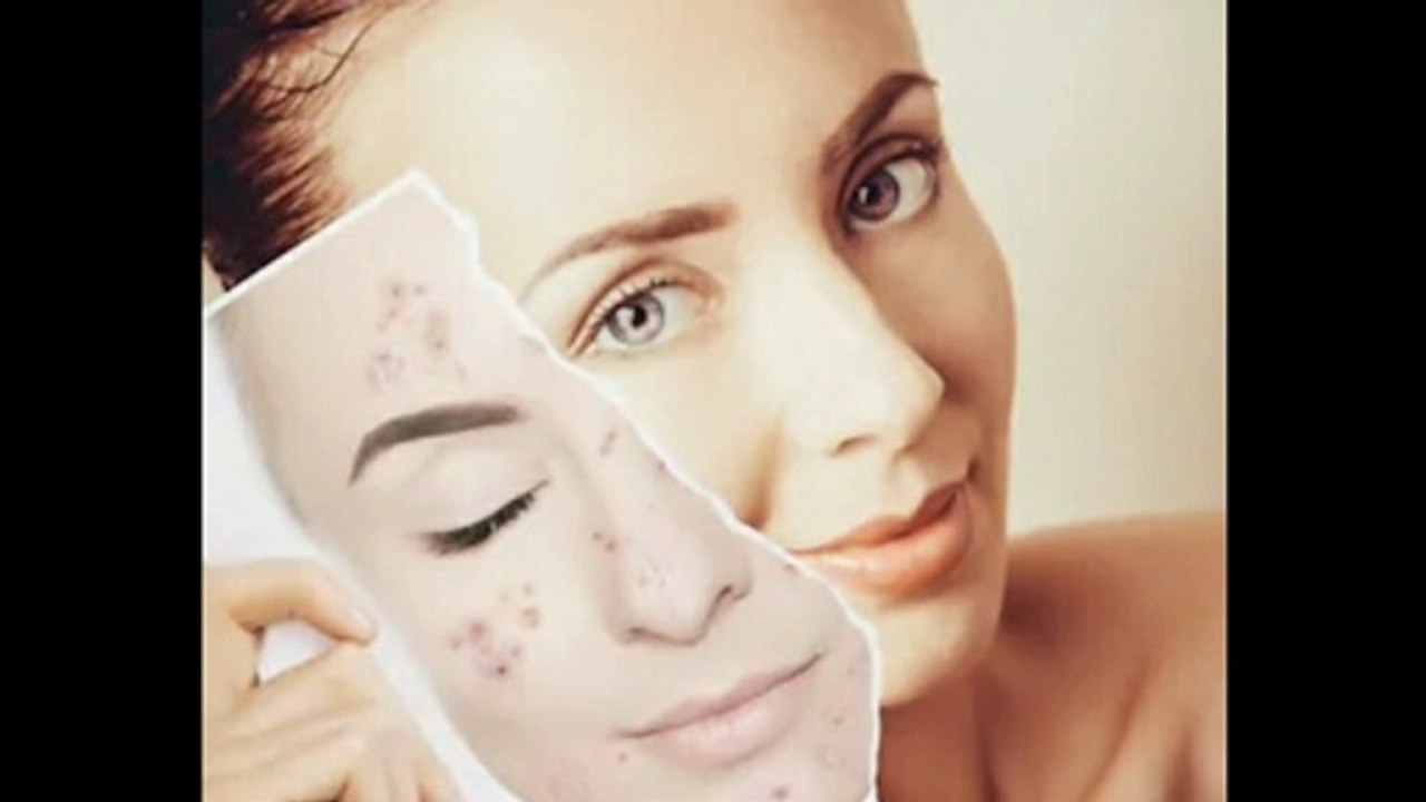 Herbal , Natural Home Remedies , HomeRemedy , Top Home Remedies , Beauty Tips , Beauty Remedies in Hindi , Natural Remedies Hindi , skin whitening home remedies , lighten skin home remedies , SKIN WHITENING Remedy , lighter skin , dark to white skin ,