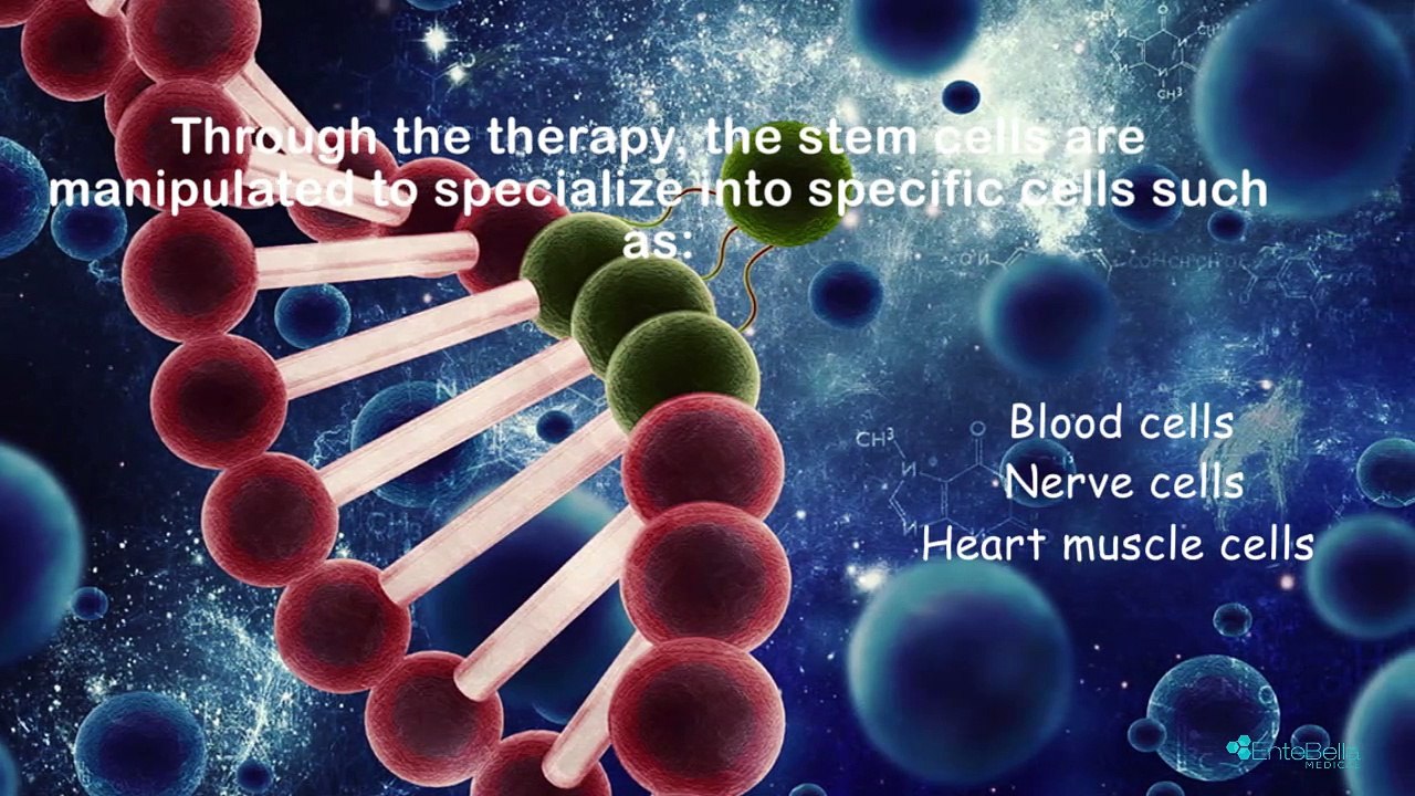 Why Do People Prefer Stem Cell Therapy for Health Issues