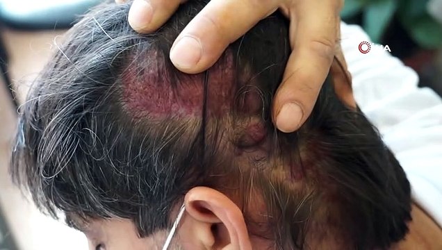 20 yıldır çekmediği acı kalmadı, hastalığına teşhis konulamadı