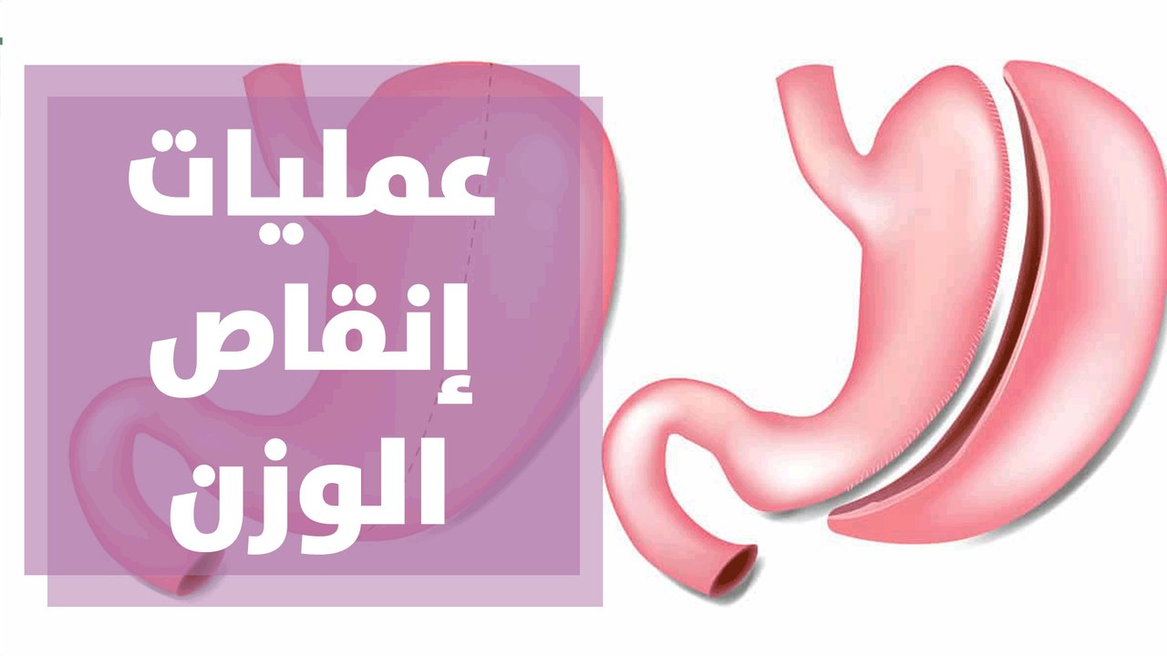 العمليات الجراحية لإنقاص الوزن..ما بين الضرورة والخطورة