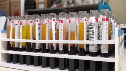 美, 코로나19 혈장치료제 긴급승인..."중대한 진전" / YTN