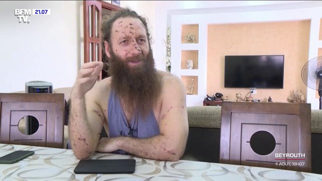 Sur le coup, j'ai cru que j'allais mourir : le corps ensanglanté et le visage strié de coupures, Chady Rizk a reçu 350 points de sutures après la déflagration à Beyrouth