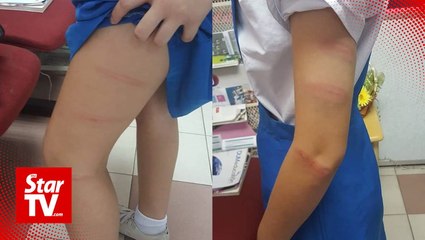 Tải video: Maszlee: Investigation underway in schoolgirl caning incident