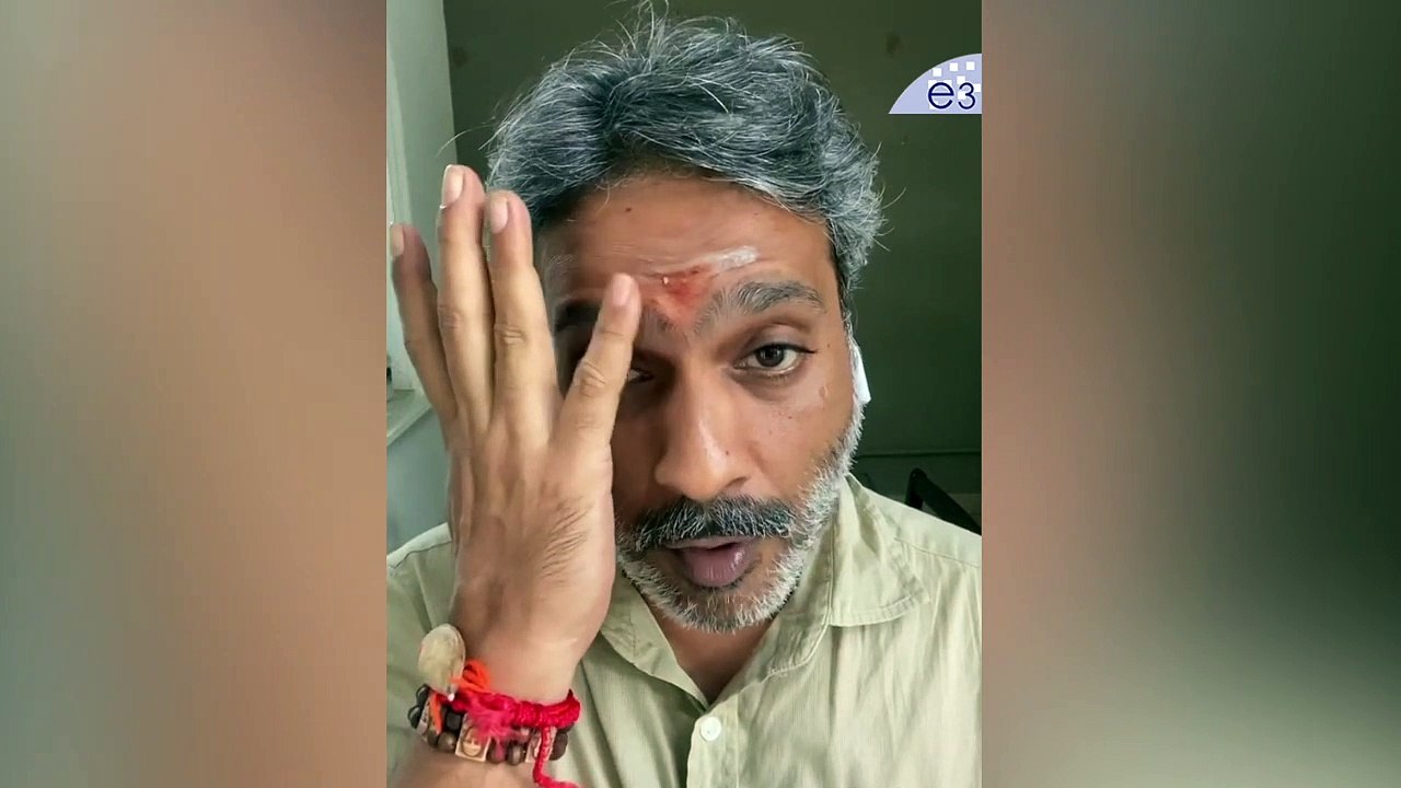 SP Charan Gives Clarity about SPB Health Condition | SP Charan | E3 Talkies