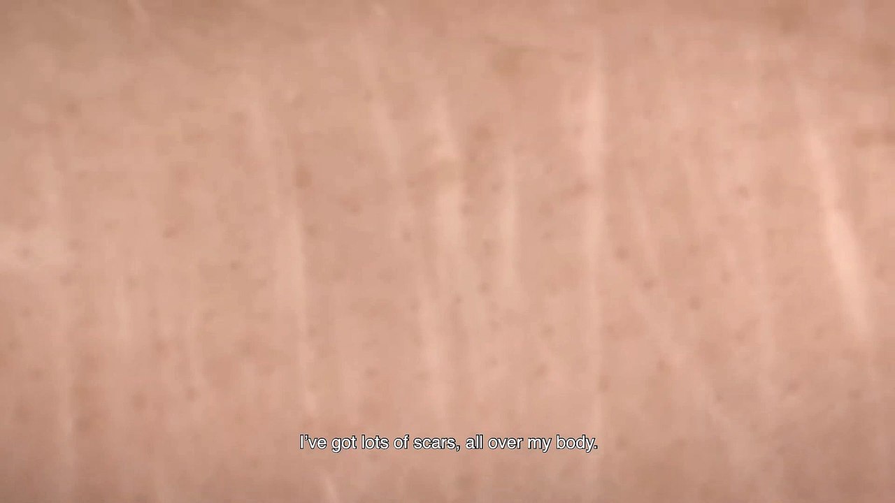 SCARS movie