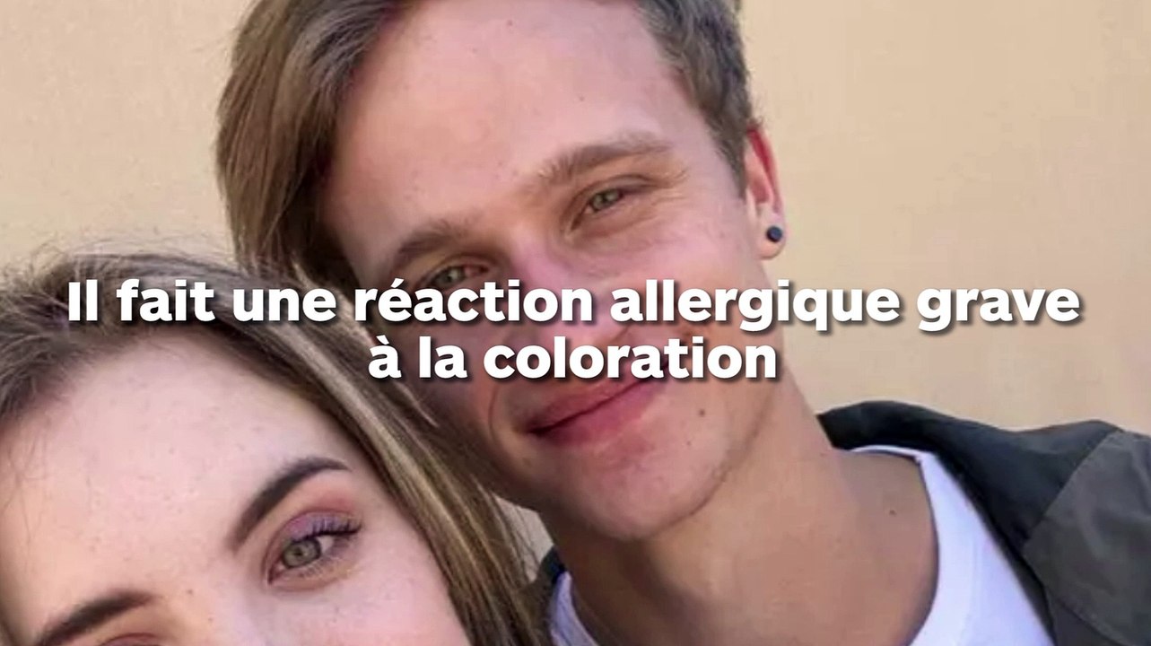 Il voulait teindre sa barbe : il est défiguré