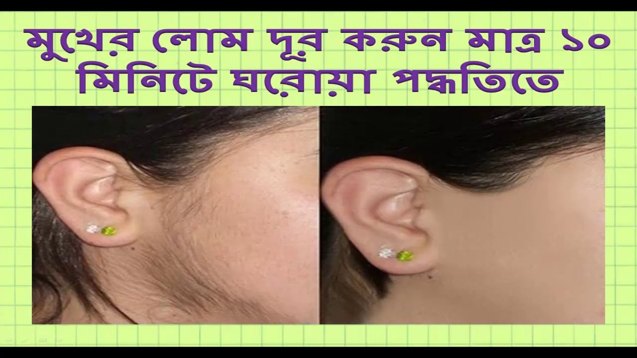 How to Remove Facial Hairs Naturally at home । Remove Facial Hair। facial hair removal । beauty tips