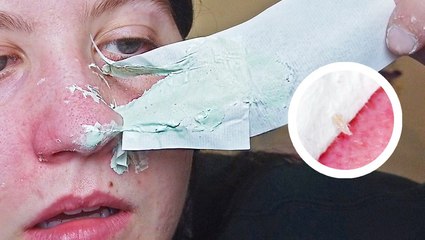 This cream mask hardens to peel off like a pore strip