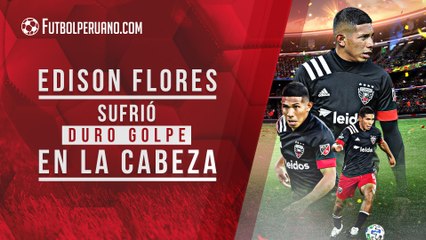 Edison Flores: así fue el duro golpe en la cabeza que lo llevó al hospital | MLS