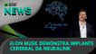 Ao Vivo | Elon Musk demonstra implante cerebral da Neuralink | 28/08/2020 #OlharDigital