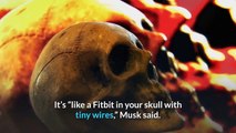 Elon Musk trots out pigs in demo of Neuralink brain implants