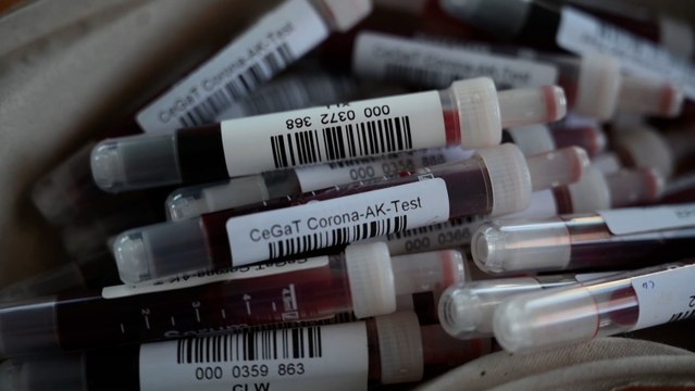 La pandemia de coronavirus supera los 25 millones de contagios