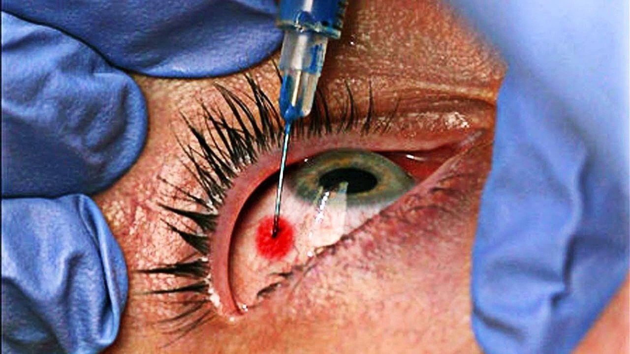 10 Most PAINFUL Things You Can Experience