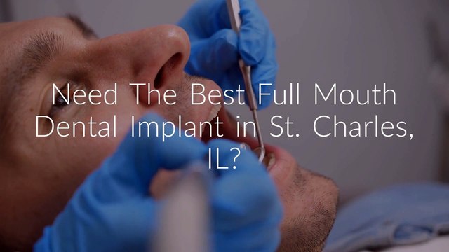 Envision a Smile : Full Mouth Dental Implant
