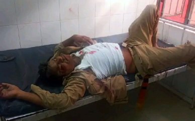 इटावा: बाइक फिसलने से दो पुलिसकर्मी हुए घायल