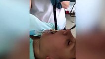 - Rusya'da uyuyan kadının ağzından giren yılan ameliyatla çıkarıldı