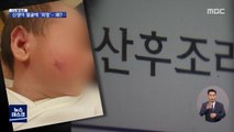 [오늘 이뉴스] 신생아 얼굴에 피멍…산후조리원에서 무슨 일이?