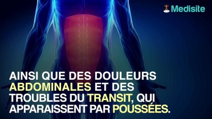 Rectocolite hémorragique : les signes d'alerte