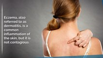 Best Eczema Diagnosis & Atopic Dermatitis Treatment in NJ