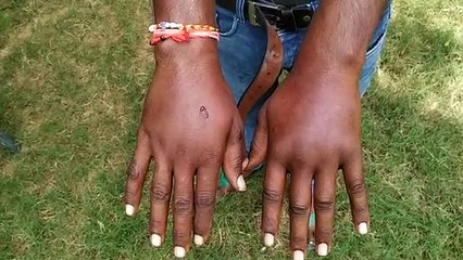 आगरा पुलिस ने सट्टे के शक में किशोर को दी थर्ड डिग्री की यातनऐं