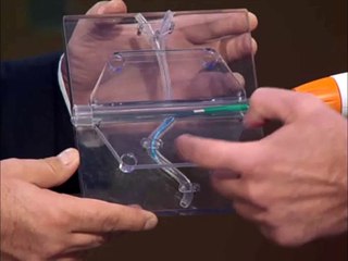 HİPERTANSİYON TEDAVİSİ 18 Eylül 2013 TRT 1