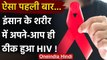 HIV AIDS: ऐसा पहली बार हुआ, जब इंसान के शरीर में अपने-आप ही खत्म हो गया Virus! | वनइंडिया हिंदी
