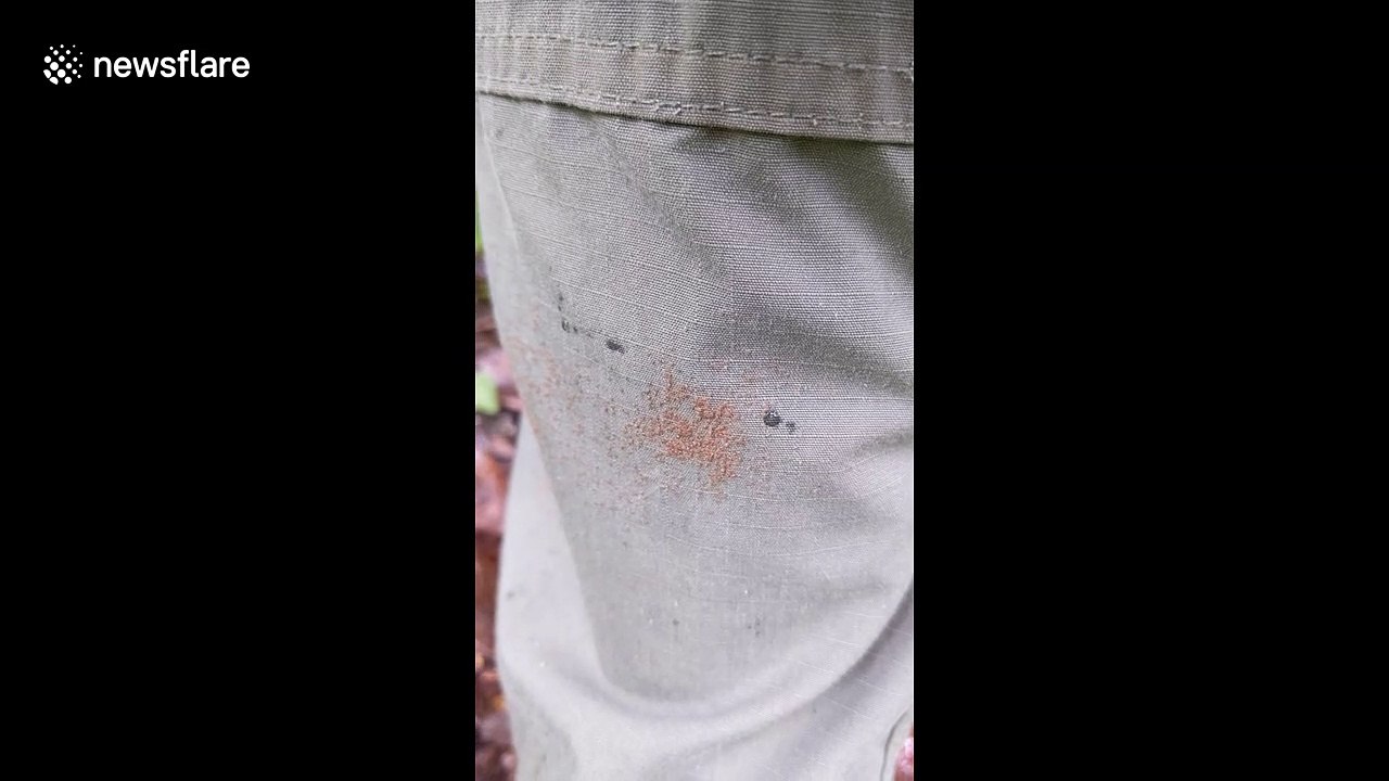 'Tick bomb' sees hundreds of baby insects crawl on Missouri man's leg