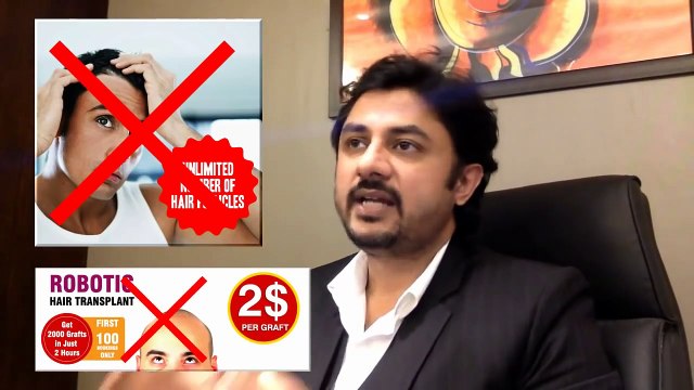 Attracted to Hair Transplant Advertisement Beware!HAIR TRANSPLANT TESTIMONIALS BEFORE AND AFTER