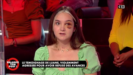 Le témoignage bouleversant de Luane agressée et tabassée dans la rue pour avoir refusé des avances