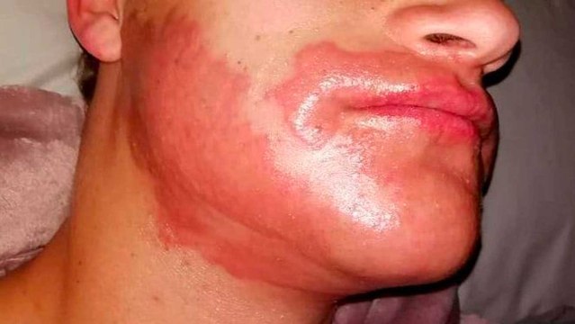 Il se teint la barbe mais ne s'attendait pas à une telle réaction