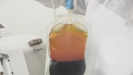 En México acuden al plasma de los recuperados para salvar vidas