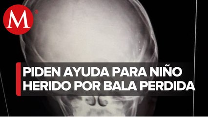 En Chimalhuacán, niño recibe bala perdida en la cabeza