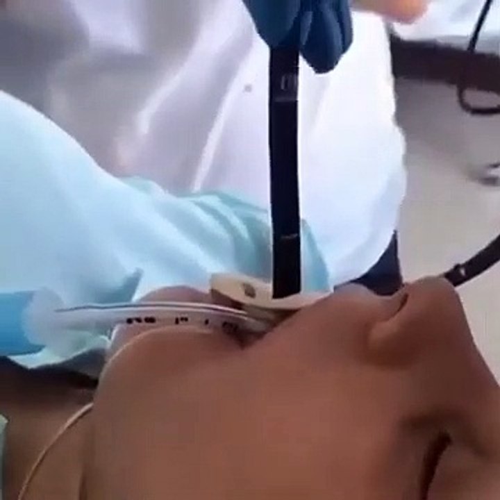 Médicos extraen serpiente del cuerpo de una mujer
