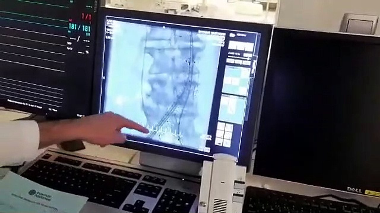 KALP HASTALIĞINDAN ÖLMEK KADERİNİZ OLMASIN !