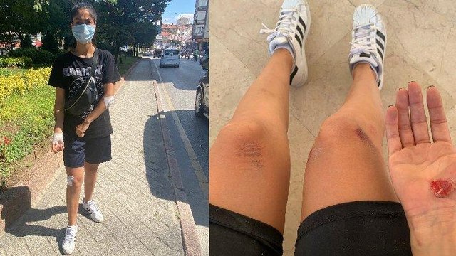 Genç kadın sokak ortasında dehşeti yaşadı!