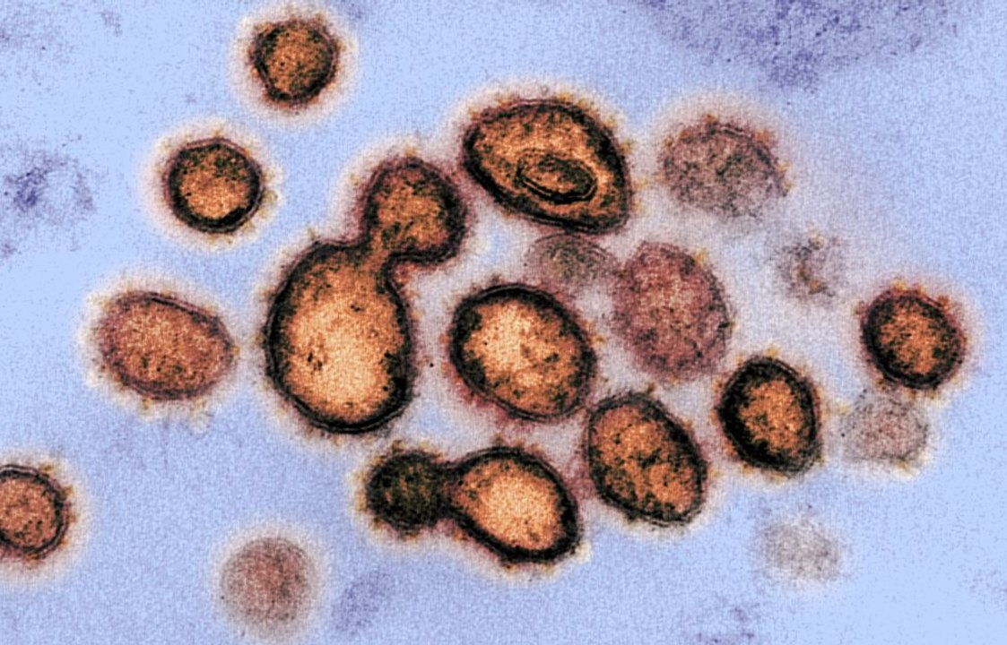 Covid-19 : pourquoi le virus tue moins aujourd'hui ?