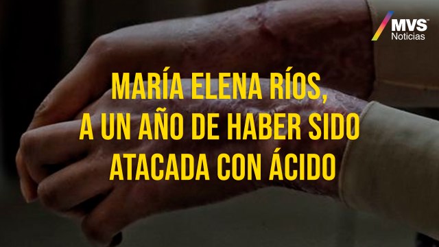 María Elena Ríos, a un año de haber sido atacada con ácido