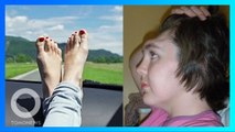 Wanita kehilangan tulang dahi karena letakkan kaki di atas dashboard mobil - TomoNews