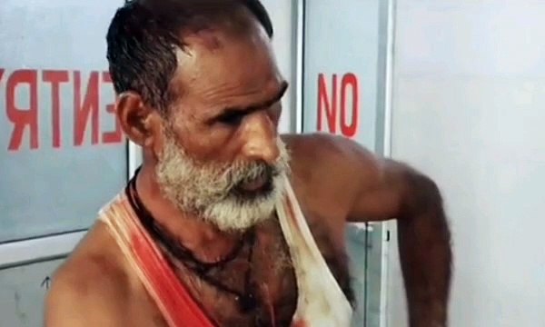 इटावा: बकरी को लेकर हुआ विवाद, 3 लोग हुए घायल