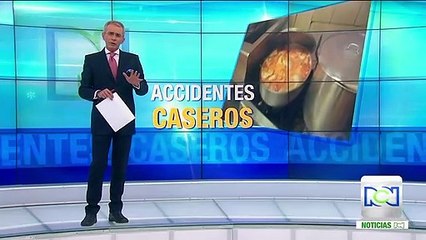 Menor de 3 años se recupera de graves quemaduras luego de haber caído en una olla