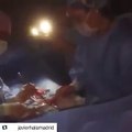 Todo el respeto y admiración para los médicos venezolanos que con las uñas hacen hasta lo imposible por salvar vidas. MaduroCoñoDeTuMadre