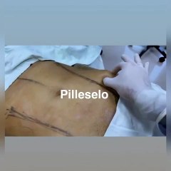 La hermana de James pasó otra vez por el quirófano