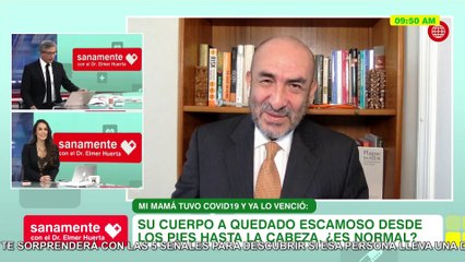 ¿Le quedó el cuerpo escamoso luego de superar el Covid? | Sanamente con el Doctor Elmer Huerta (HOY)