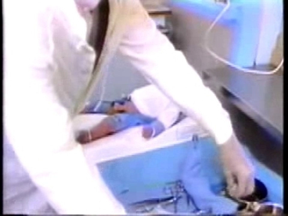 Is Circumcision Traumatic for babies?