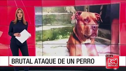 Mujer de 76 años fue atacada brutalmente por un perro de raza pitbull
