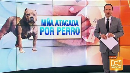 Download Video: Menor resultó con graves heridas al ser atacada por un perro en Bogotá