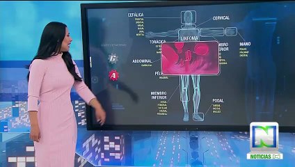 Su Salud: el linfoma o cáncer linfático, la séptima causa de muerte en Colombia