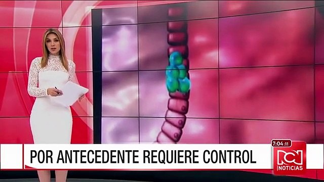 ¿En qué consisten los exámenes a los que se someterá el Presidente Santos?