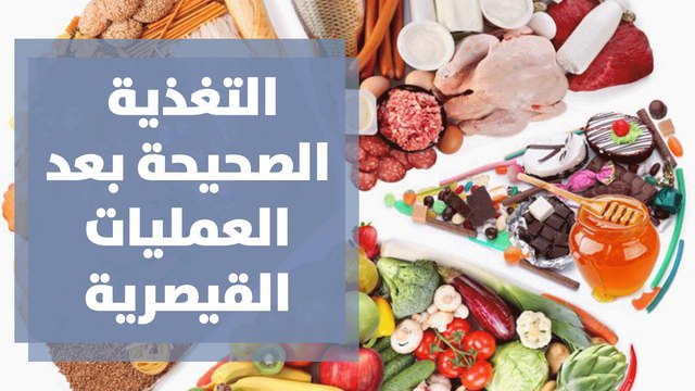 التغذية الصحيحة بعد العمليات القيصرية